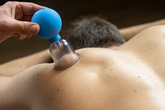 Darstellung Schröpfmassage